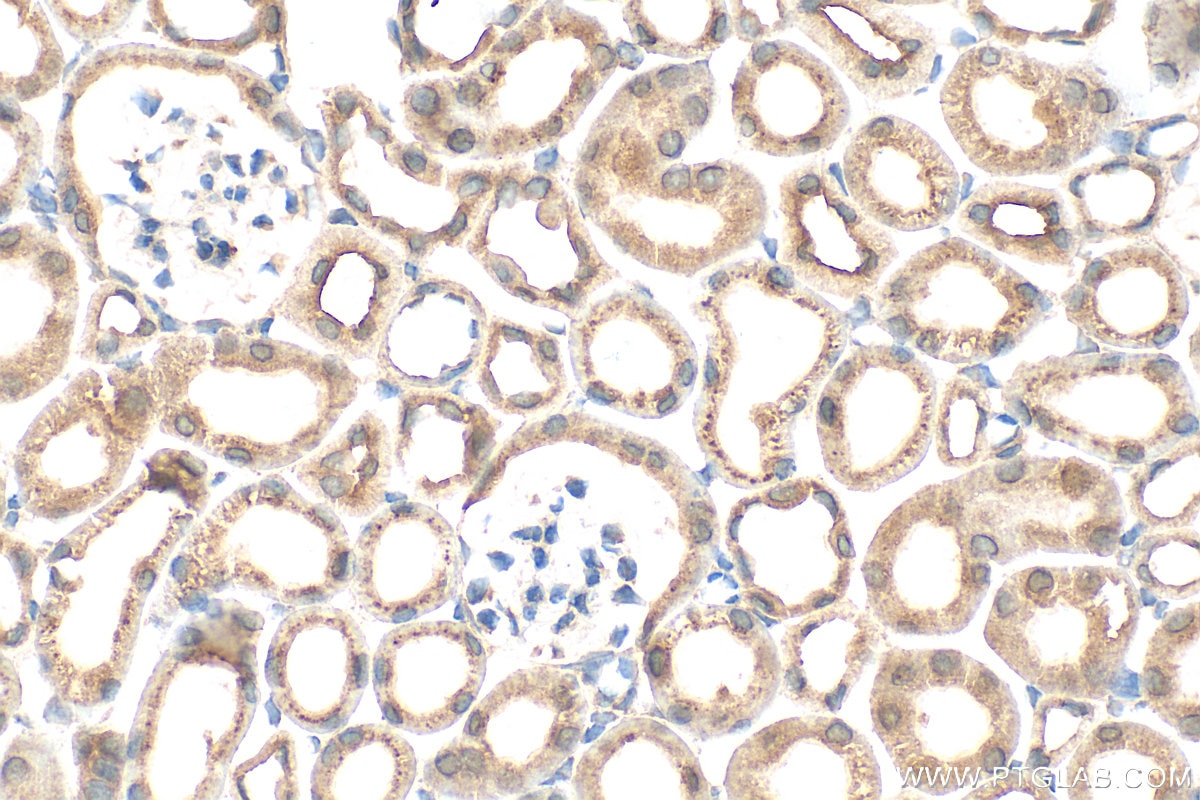 Immunohistochemical analysis of paraffin-embedded mouse kidney tissue slide using 33280-1-AP (NOTCH4 antibody) at dilution of 1:200 (under 40x lens). Heat mediated antigen retrieval with Tris-EDTA buffer (pH 9.0). Immunohistochemistry (IHC) staining of mouse kidney tissue using NOTCH4 Polyclonal antibody (33280-1-AP)