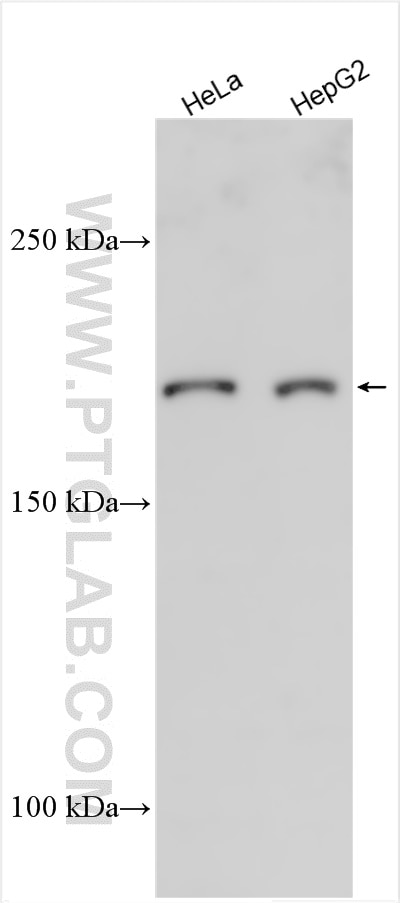 Various lysates were subjected to SDS PAGE followed by western blot with 33280-1-AP (NOTCH4 antibody) at dilution of 1:1000 incubated at room temperature for 1.5 hours. Western Blot (WB) analysis of various lysates using NOTCH4 Polyclonal antibody (33280-1-AP)