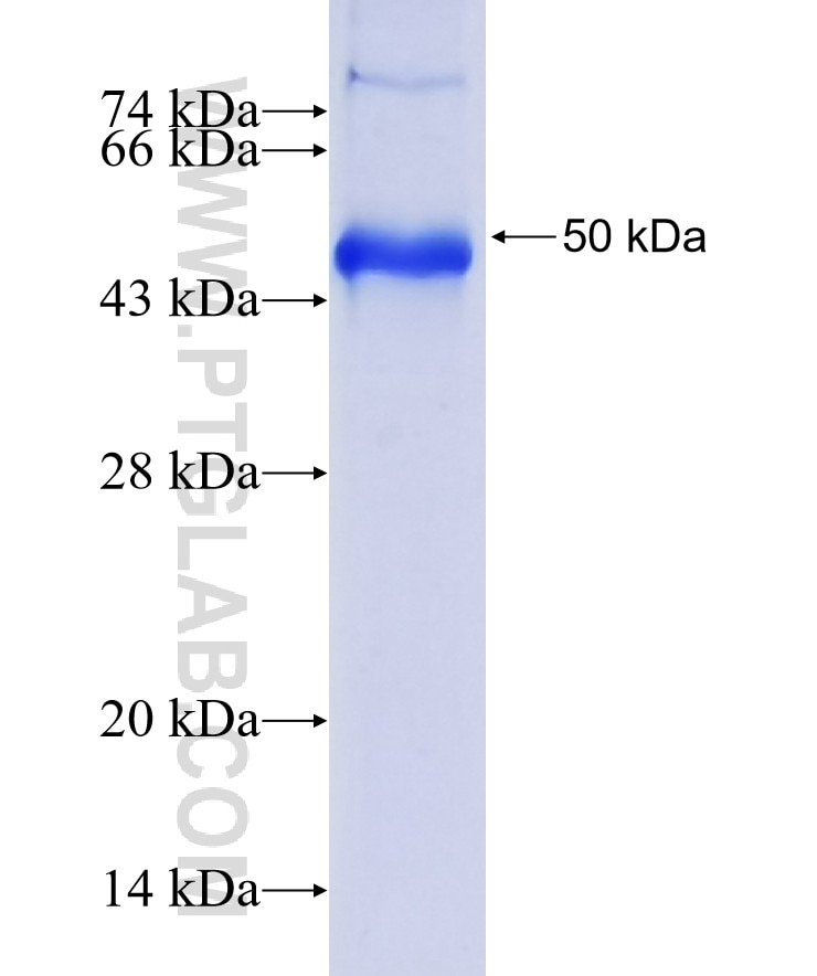 NOTCH4 fusion protein Ag36738 SDS-PAGE NOTCH4 fusion protein Ag36738 SDS-PAGE