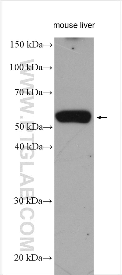 Western Blot (WB) analysis of various lysates using NOTUM Polyclonal antibody (14663-1-AP)