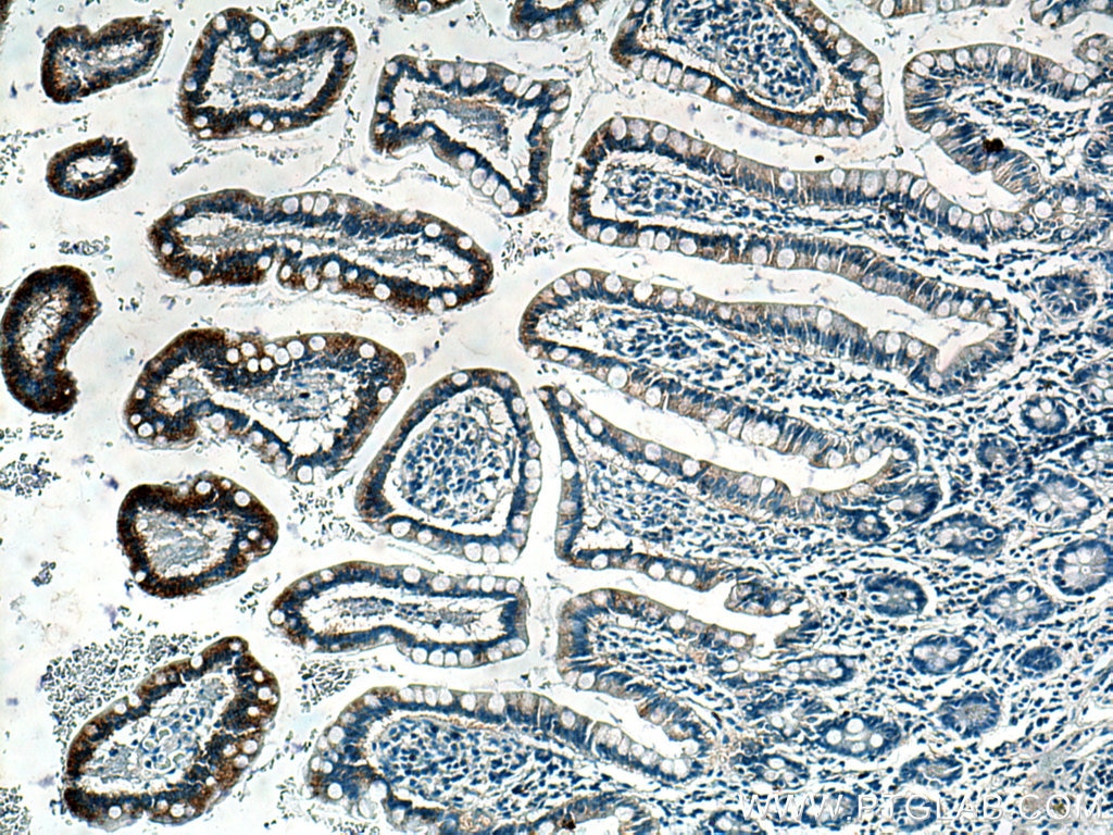 Immunohistochemistry (IHC) staining of human small intestine tissue using NOTUM Monoclonal antibody (66956-1-Ig)