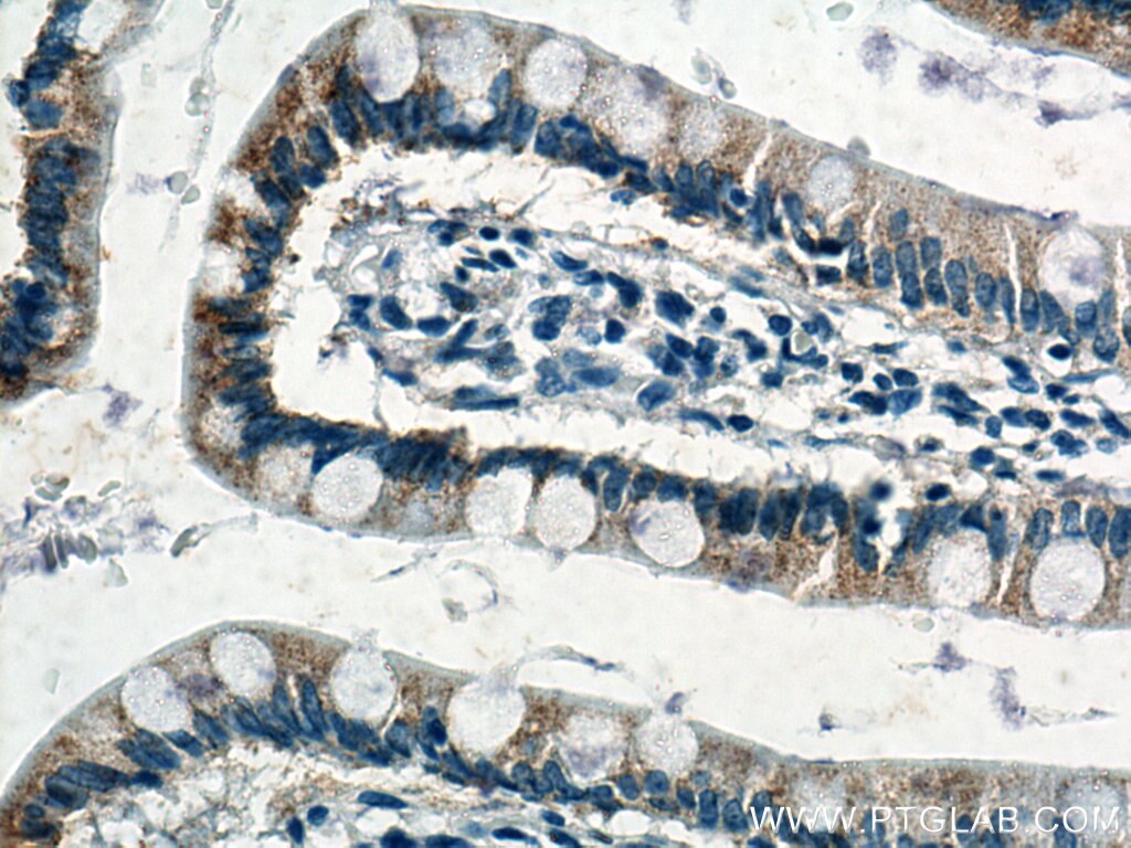 Immunohistochemistry (IHC) staining of human small intestine tissue using NOTUM Monoclonal antibody (66956-1-Ig)