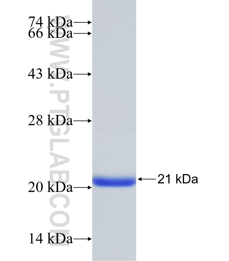 NOTUM fusion protein Ag31010 SDS-PAGE NOTUM fusion protein Ag31010 SDS-PAGE