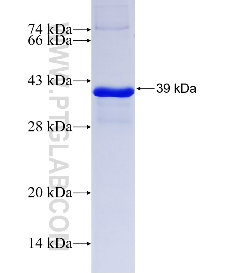 NOTUM fusion protein Ag6338 SDS-PAGE