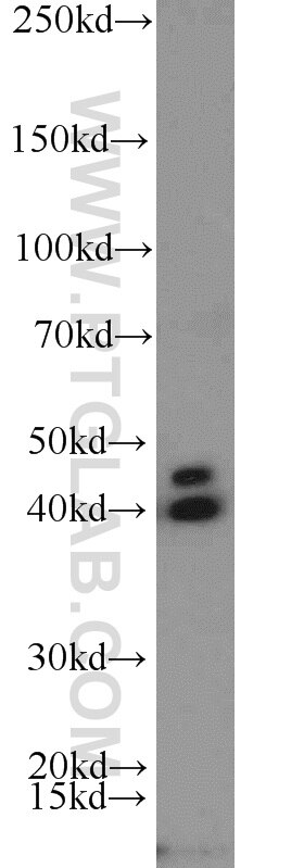 NOV Polyclonal antibody