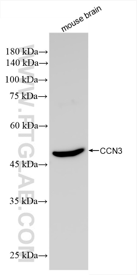 Western Blot (WB) analysis of various lysates using NOV/CCN3 Recombinant antibody (85731-1-RR)