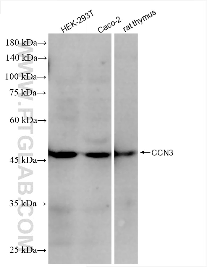Western Blot (WB) analysis of various lysates using NOV/CCN3 Recombinant antibody (85731-1-RR)