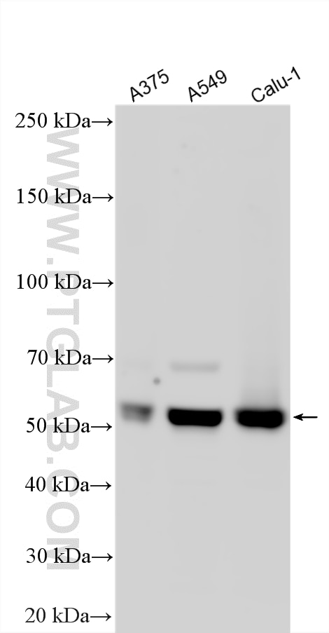 WB analysis using 18209-1-AP Western Blot (WB) analysis of various lysates using NOVA1 Polyclonal antibody (18209-1-AP)
