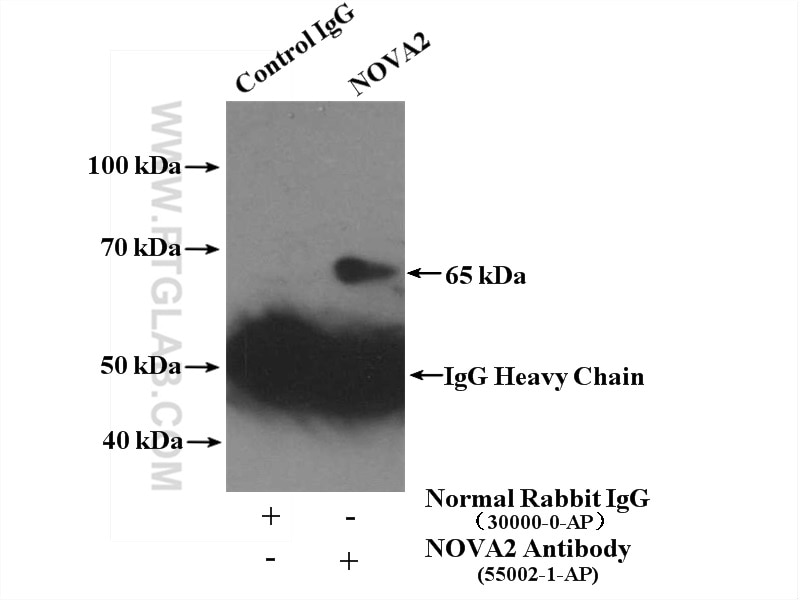 Immunoprecipitation (IP) experiment of mouse brain tissue using NOVA2 Polyclonal antibody (55002-1-AP)