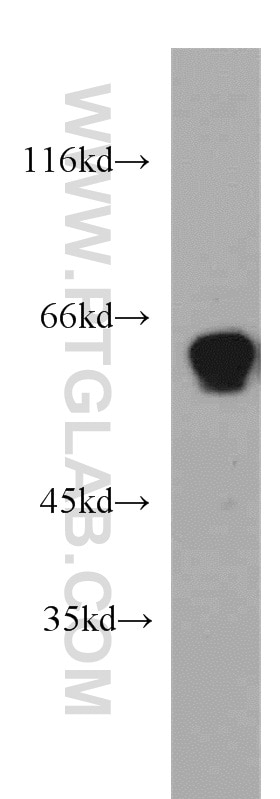 WB analysis of mouse brain using 55002-1-AP