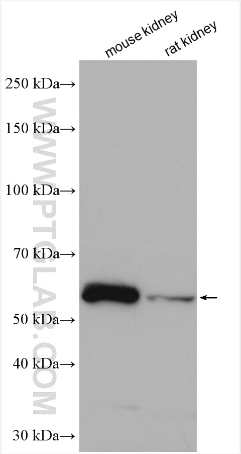 Western Blot (WB) analysis of various lysates using NOX1 Polyclonal antibody (17772-1-AP)