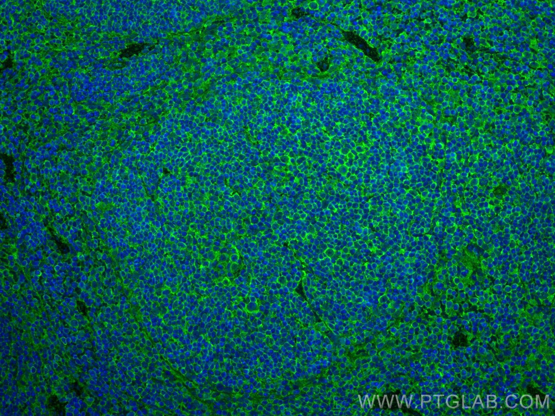 IF Staining of mouse spleen using 82872-1-RR