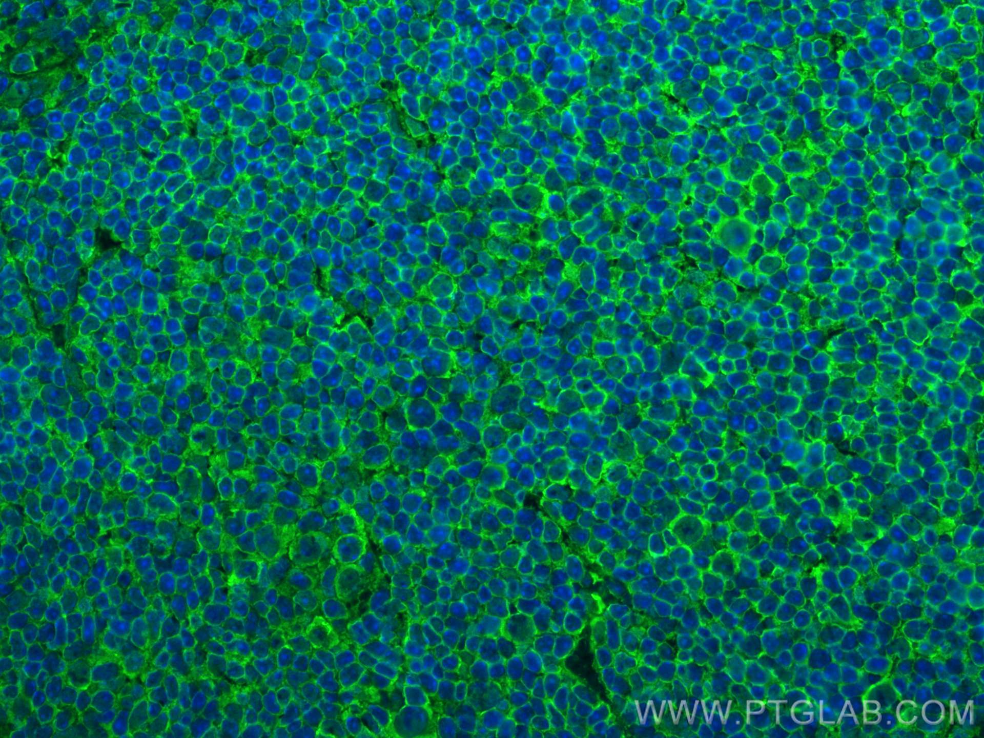 IF Staining of mouse spleen using 82872-1-RR