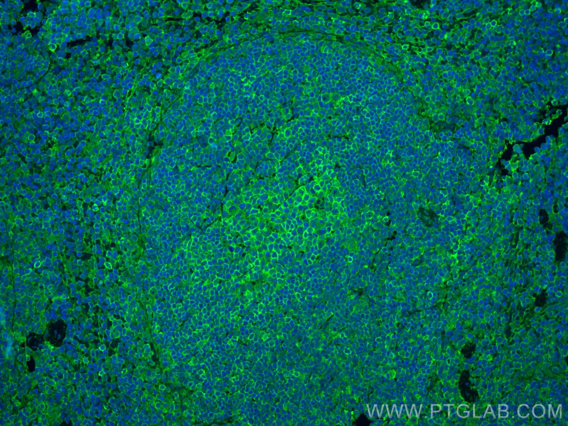 IF Staining of mouse spleen using 82872-1-RR