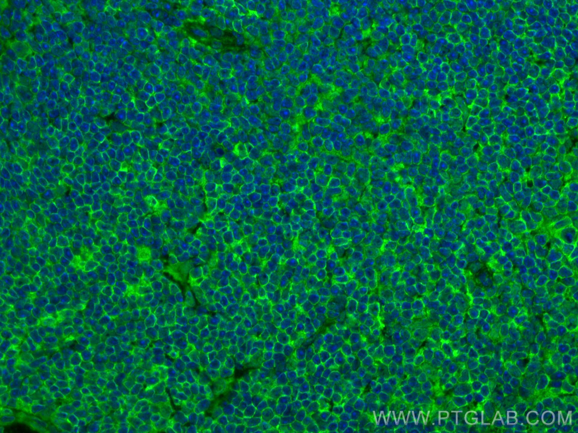 Immunofluorescence (IF) / fluorescent staining of mouse spleen tissue using NOX2 Recombinant antibody (82872-1-RR)