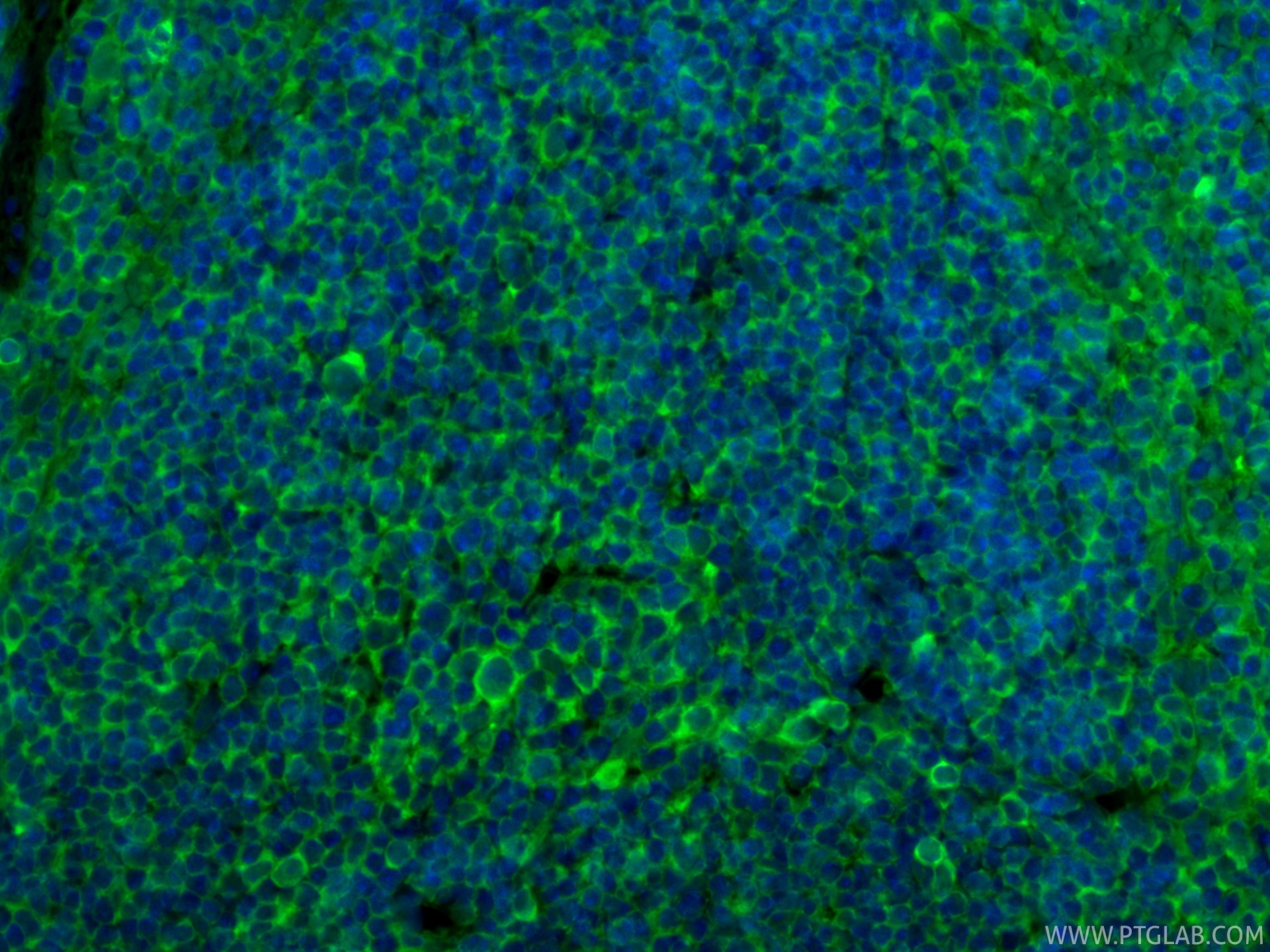 Immunofluorescent analysis of (4% PFA) fixed paraffin-embedded mouse spleen tissue using CoraLite® Plus 488 NOX2 antibody (CL488-82872, Clone: 1B17 ) at dilution of 1:200. Heat mediated antigen retrieval with Tris-EDTA buffer (pH 9.0). Immunofluorescence (IF) / fluorescent staining of mouse spleen tissue using CoraLite® Plus 488-conjugated NOX2 Recombinant mon (CL488-82872)