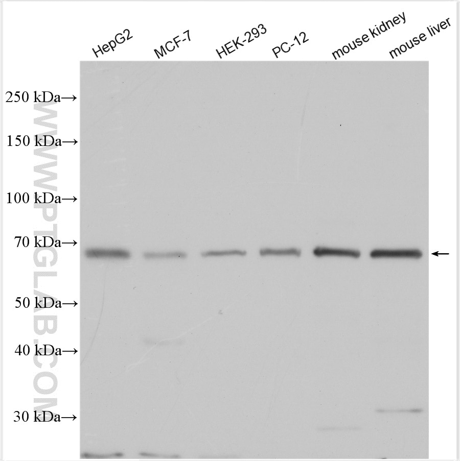 Western Blot (WB) analysis of various lysates using NOX3 Polyclonal antibody (30131-1-AP)