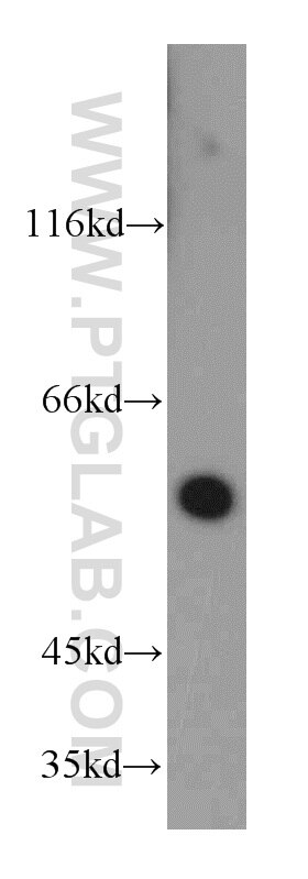 Western Blot (WB) analysis of human brain tissue using NOX3-Specific Polyclonal antibody (20065-1-AP)