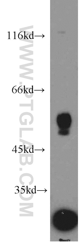 Western Blot (WB) analysis of mouse brain tissue using NOX3-Specific Polyclonal antibody (20065-1-AP)