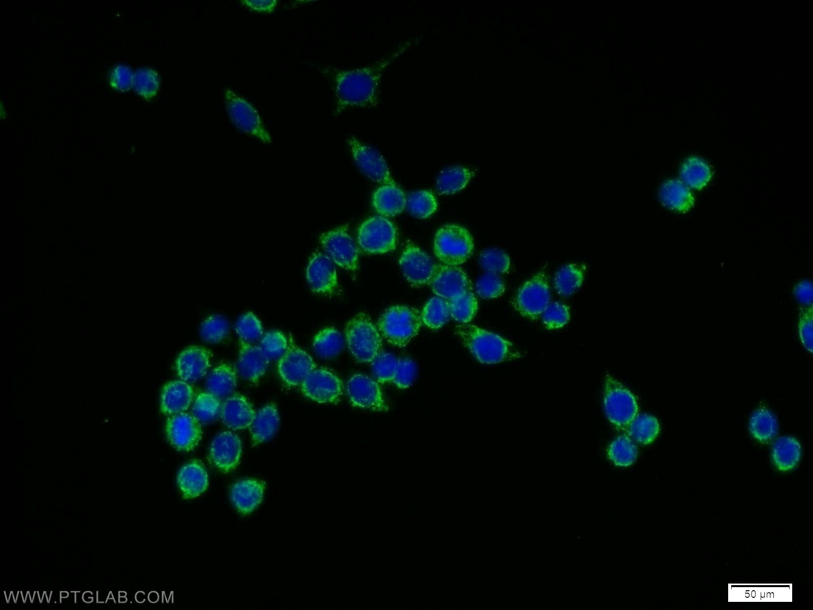 Immunofluorescence (IF) / fluorescent staining of BxPC-3 cells using NOX4 Polyclonal antibody (14347-1-AP)