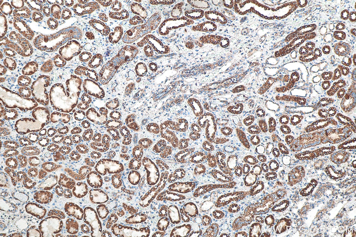 Immunohistochemistry (IHC) staining of human kidney tissue using NOX4 Polyclonal antibody (14347-1-AP)