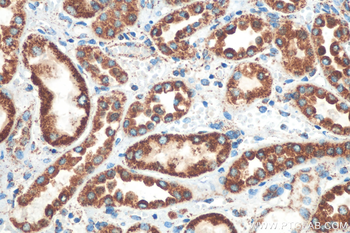 Immunohistochemistry (IHC) staining of human kidney tissue using NOX4 Polyclonal antibody (14347-1-AP)