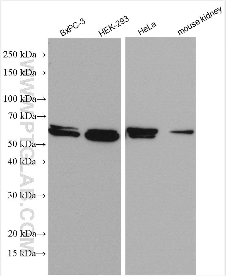 Western Blot (WB) analysis of various lysates using NOX4 Polyclonal antibody (14347-1-AP)