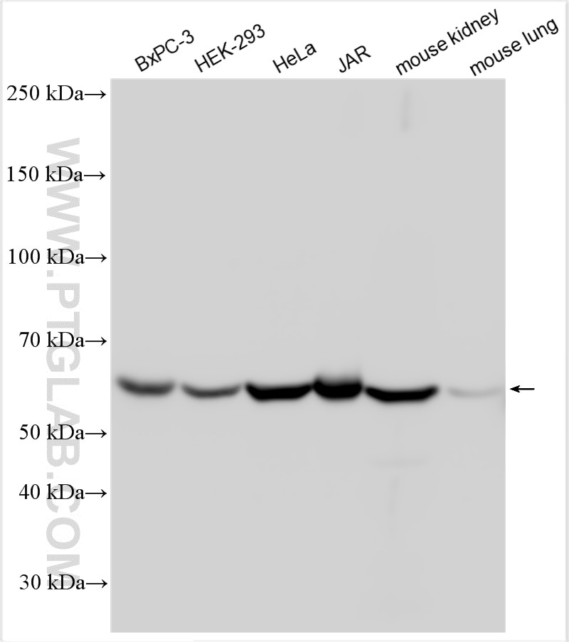 Western Blot (WB) analysis of various lysates using NOX4 Polyclonal antibody (14347-1-AP)