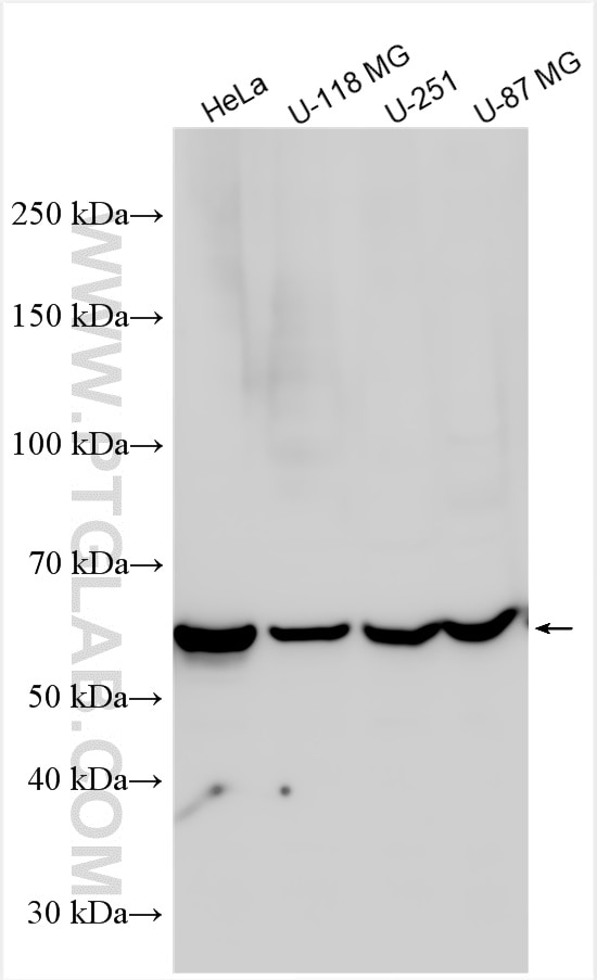 Western Blot (WB) analysis of various lysates using NOX4 Polyclonal antibody (14347-1-AP)