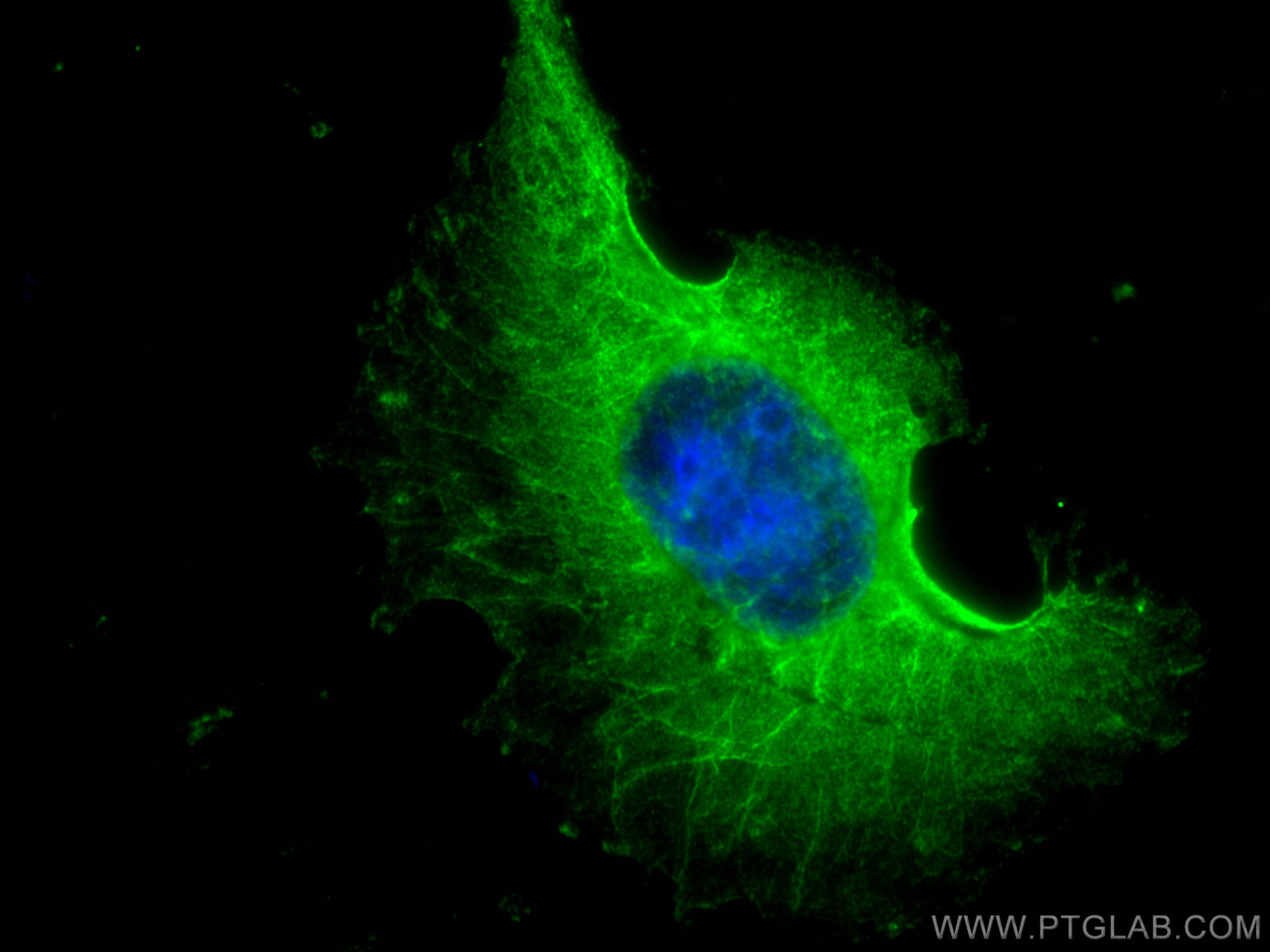 Immunofluorescence (IF) / fluorescent staining of HUVEC cells using NOX4 Monoclonal antibody (67681-1-Ig)