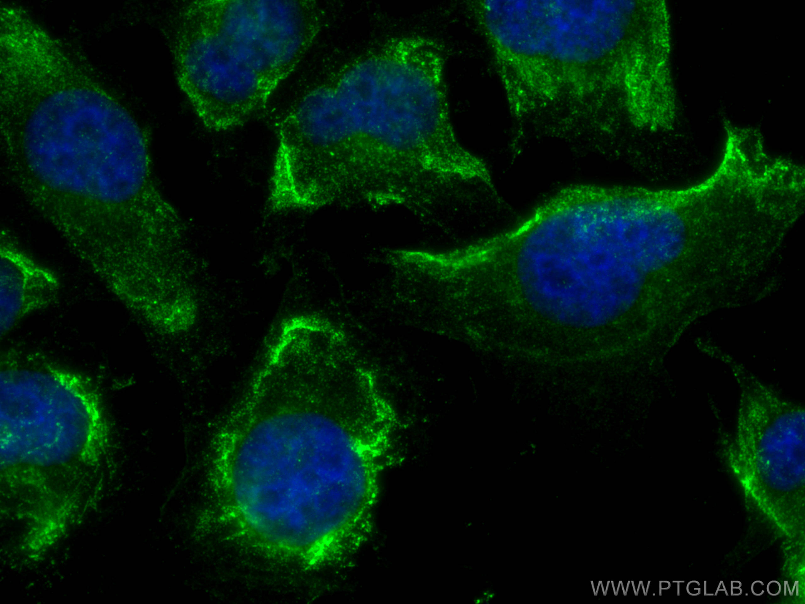 Immunofluorescence (IF) / fluorescent staining of HUVEC cells using NOX4 Monoclonal antibody (67681-1-Ig)