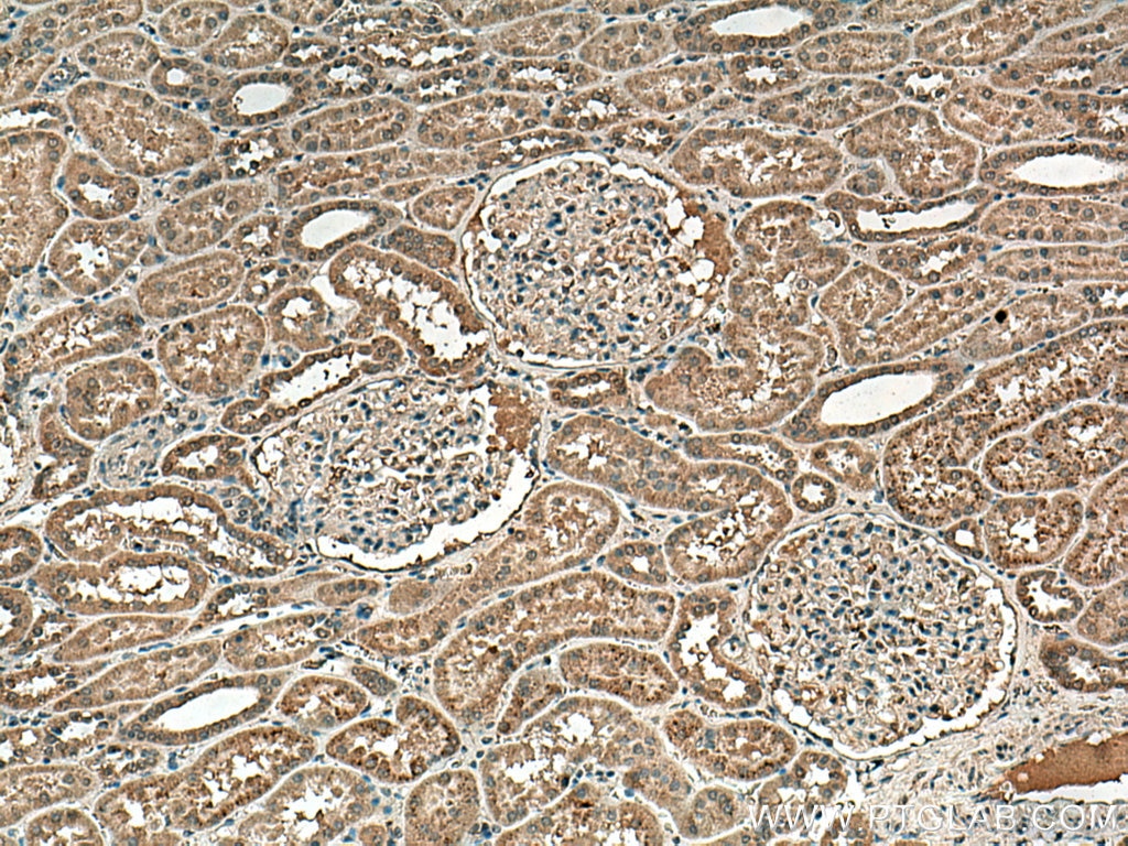 Immunohistochemistry (IHC) staining of human kidney tissue using NOX4 Monoclonal antibody (67681-1-Ig)