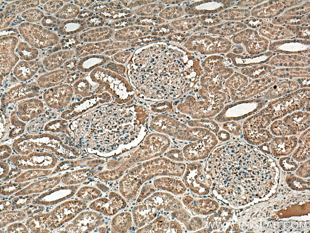 IHC staining of human kidney using 67681-1-Ig