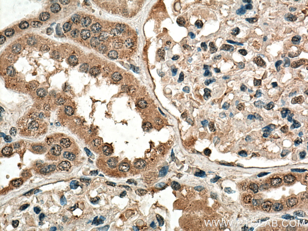 Immunohistochemistry (IHC) staining of human kidney tissue using NOX4 Monoclonal antibody (67681-1-Ig)