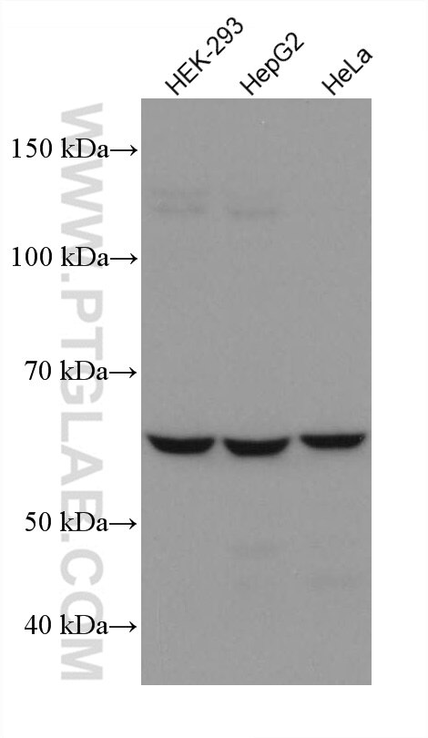 Western Blot (WB) analysis of various lysates using NOX4 Monoclonal antibody (67681-1-Ig)