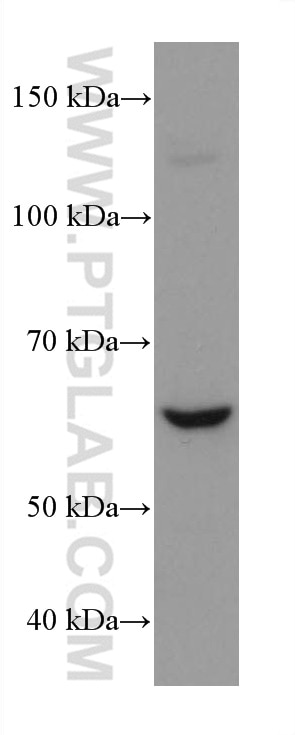 Western Blot (WB) analysis of Jurkat cells using NOX4 Monoclonal antibody (67681-1-Ig)
