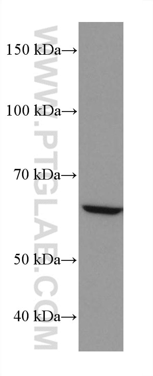 Western Blot (WB) analysis of U-87 MG cells using NOX4 Monoclonal antibody (67681-1-Ig)