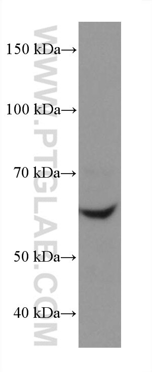 Western Blot (WB) analysis of HSC-T6 cells using NOX4 Monoclonal antibody (67681-1-Ig)