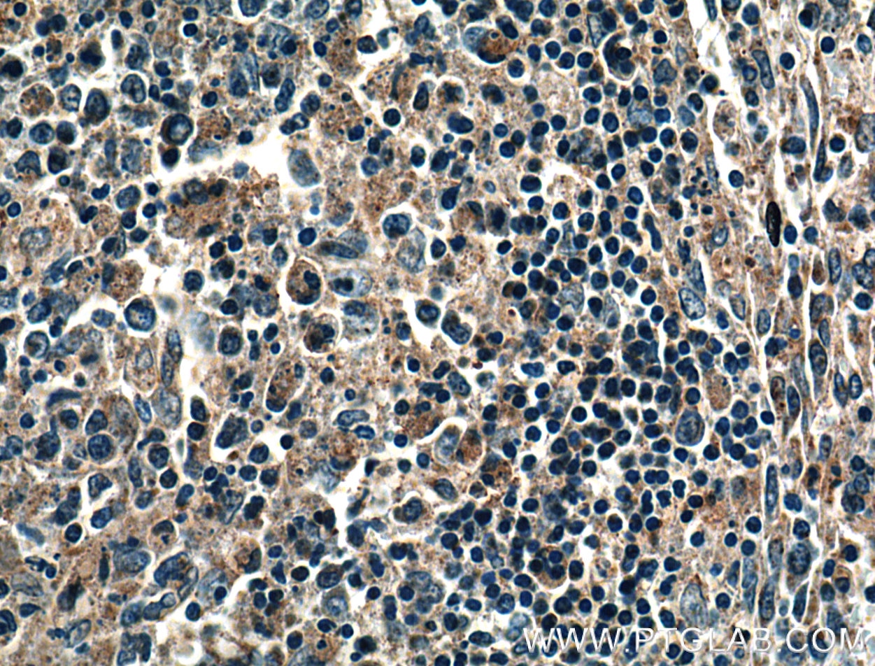 Immunohistochemistry (IHC) staining of human spleen tissue using NOX5 Polyclonal antibody (25350-1-AP)