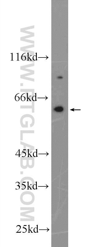 NOX5 Polyclonal antibody