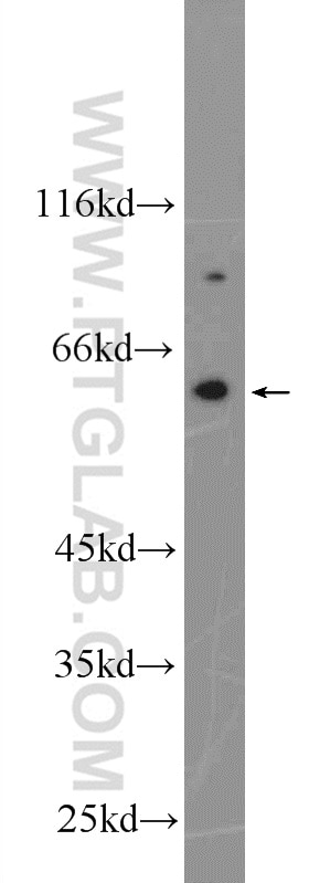 NOX5 Polyclonal antibody