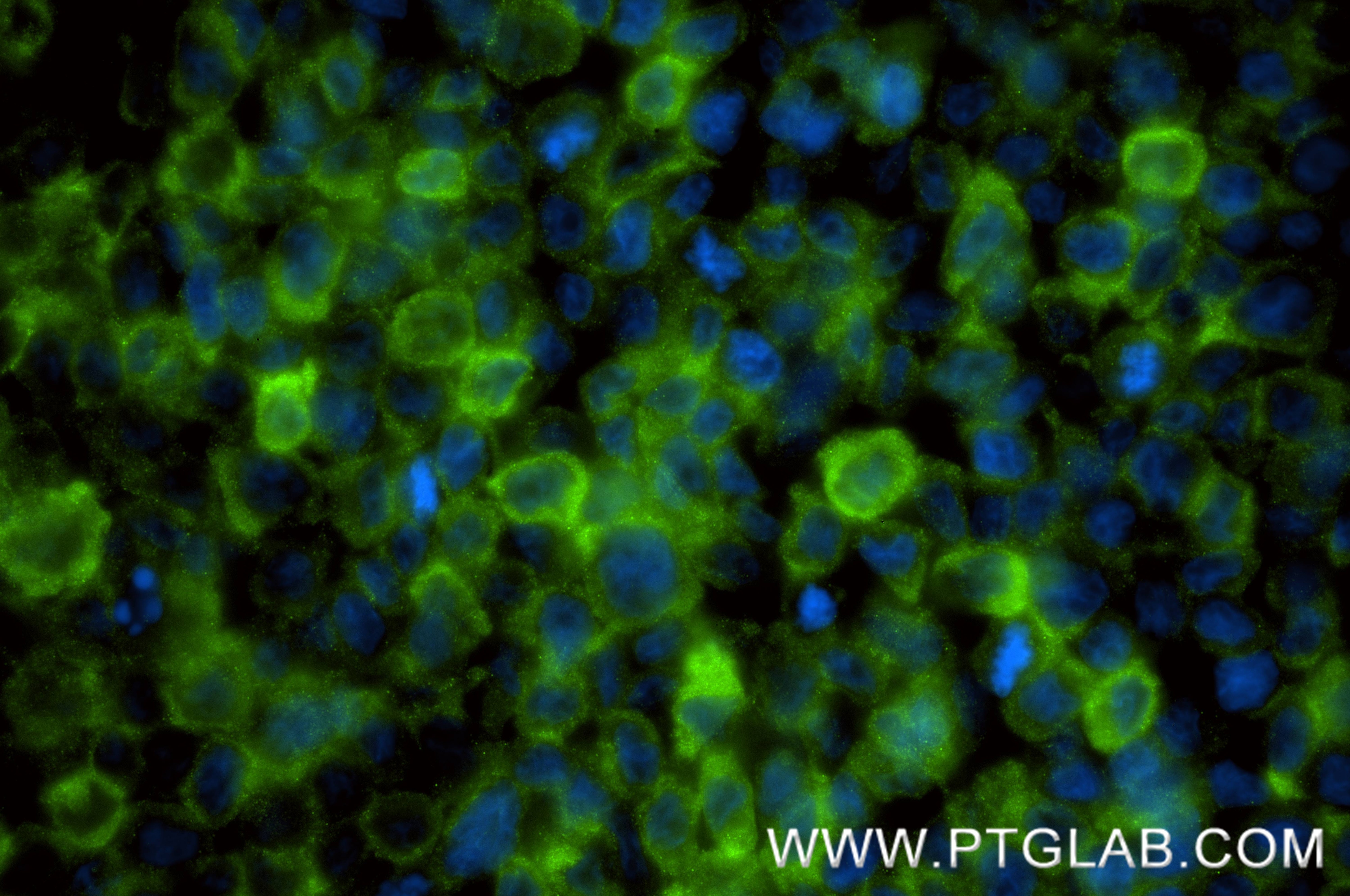 IF Staining of THP-1 using 88418-1-RR Immunofluorescence (IF) / fluorescent staining of THP-1 cells using NOXA2/p67phox Recombinant monoclonal antibody (88418-1-RR)