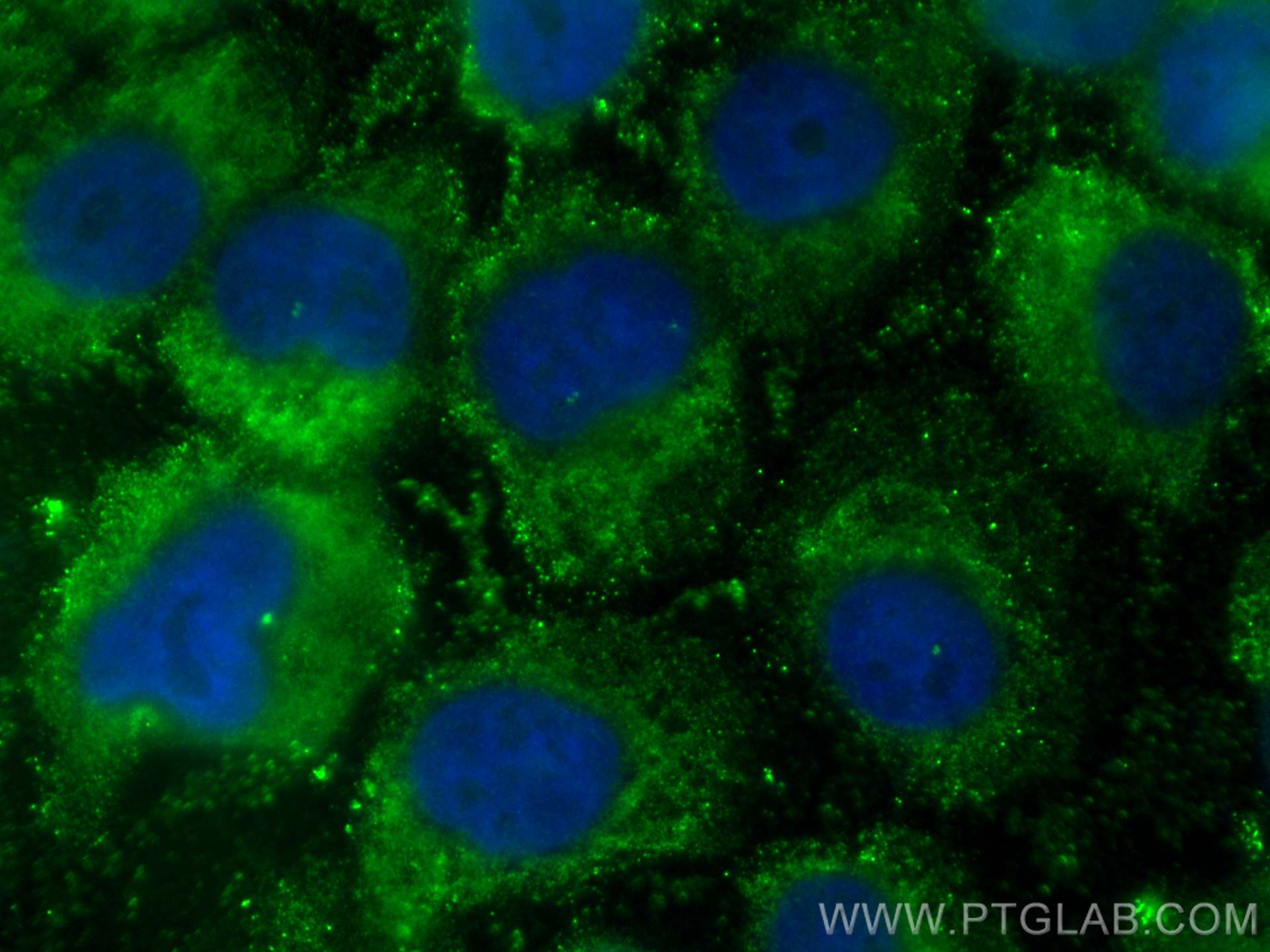 Immunofluorescence (IF) / fluorescent staining of A431 cells using CoraLite® Plus 488-conjugated NOXA2/p67phox Monocl (CL488-67594)
