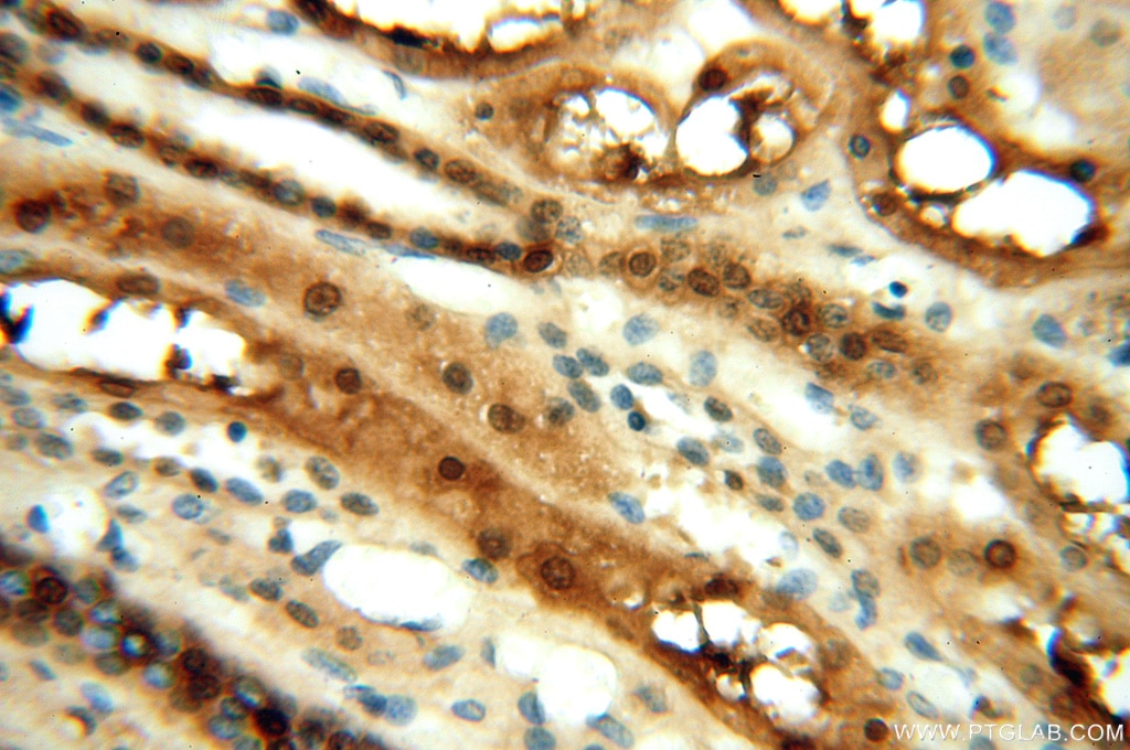 Nucleoside phosphorylase