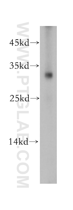 Western Blot (WB) analysis of U-937 cells using Nucleoside phosphorylase Polyclonal antibody (18009-1-AP)