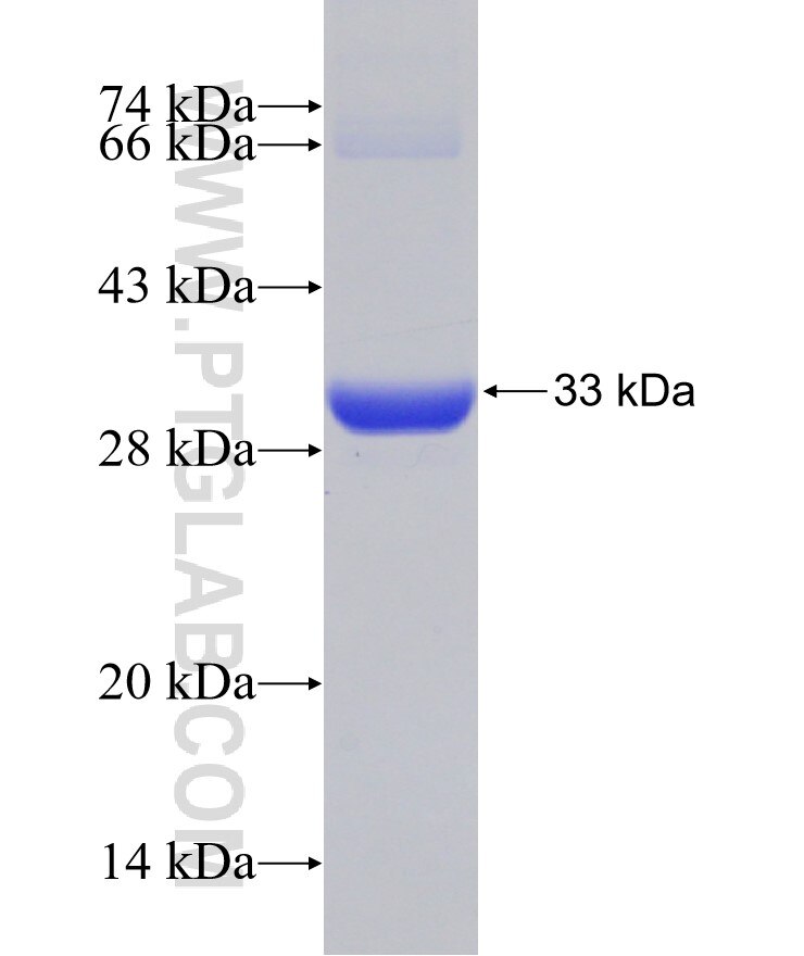 NP fusion protein Ag12485 SDS-PAGE