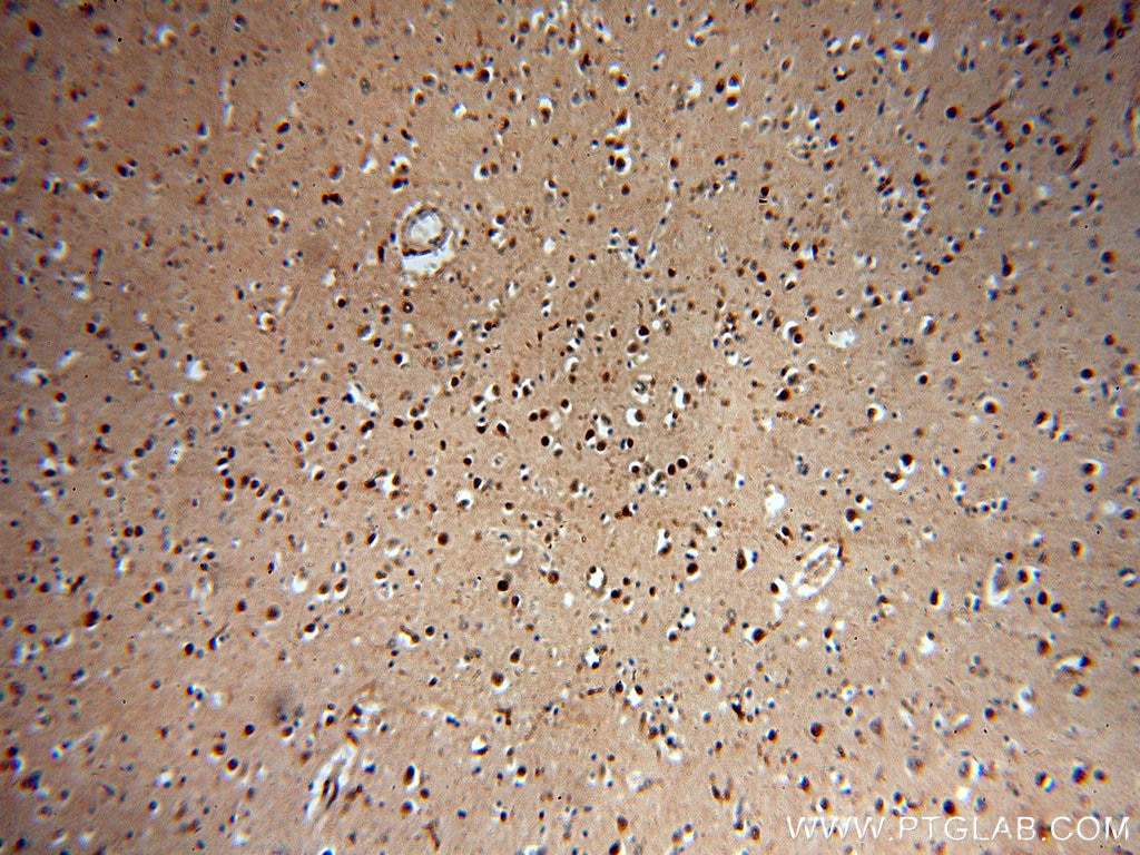 Immunohistochemistry (IHC) staining of human brain tissue using NPAS1 Polyclonal antibody (13701-1-AP)