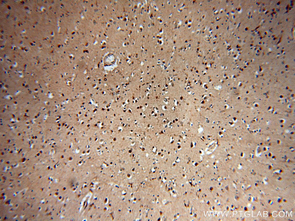 Immunohistochemistry (IHC) staining of human brain tissue using NPAS1 Polyclonal antibody (13701-1-AP)