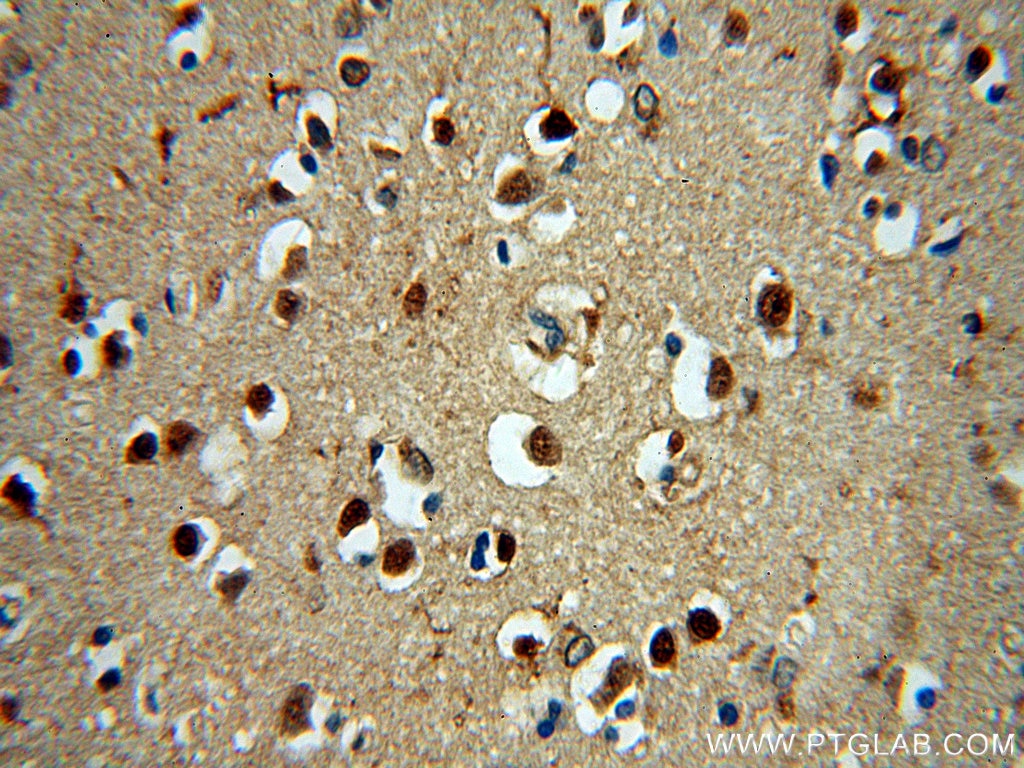 Immunohistochemistry (IHC) staining of human brain tissue using NPAS1 Polyclonal antibody (13701-1-AP)