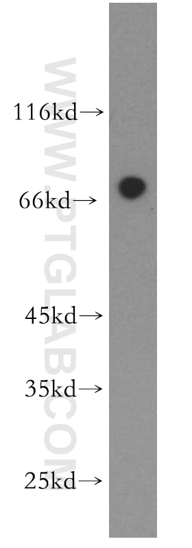 Western Blot (WB) analysis of human brain tissue using NPAS1 Polyclonal antibody (13701-1-AP)